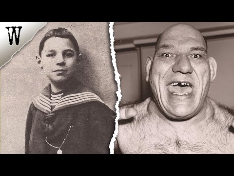 The Haunting STRANGE CASE of Maurice Tillet